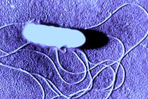 Listeria monocytogenes, фото с сайта wales.nhs.uk