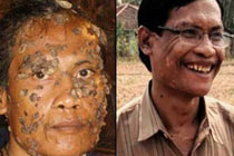 Фото news.com.au с Медпортала