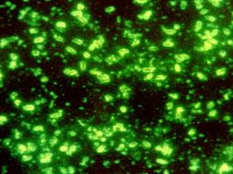 Возбудитель чумы Yersinya pestis при флюоресцентной микроскопии, фото с сайта ru.wikipedia.org