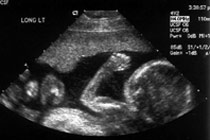 Фото с сайта www.rootsweb.com