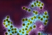 Энтеровирусы Коксаки, иллюстрация sciencephoto.com