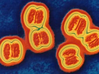 Менингококк (Neisseria meningitidis), иллюстрация с сайта zdravstvena.info