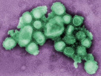 Вирусы гриппа H1N1 под микроскопом. Фото с сайта healthspablog.org