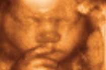 Фото с сайта baby-ultrasound.com 