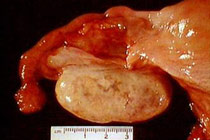 Здоровый яичник, фото с сайта www-medlib.med.utah.edu