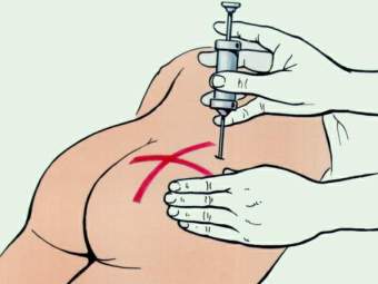 Haldol im injection