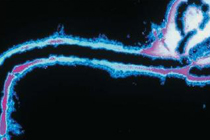 Вирус Эбола, фото с сайта scienceclarified.com