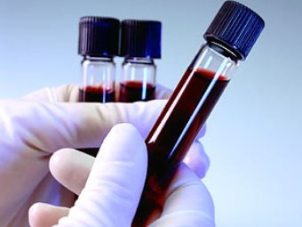 Изображение с сайта www.pharmacyescrow.com