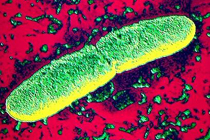 Чумная палочка Iersinia pestis, иллюстрация с сайта webs.wichita.edu
