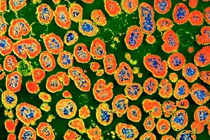 Возбудитель гонореи - гонококк. Иллюстрация с сайта biologyreference.com