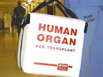 Фото с сайта cambridge-transplant.org.uk