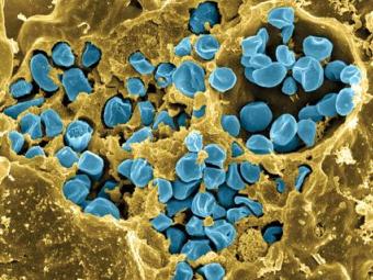 Возбудитель туляремии (выделен синим). Изображение с сайта www.pnas.org