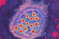 Вирус гепатита A, иллюстрация с сайта hepatitisblog.com