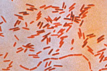 Бактерия Salmonella typhi, (семейство Enterobacteriacae) - возбудитель тифа