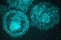 Вирус иммунодефицита человека, фото с сайта www.hiv.ch