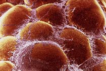 Жировые клетки, микрофотография с сайта www.diabetologia-journal.org