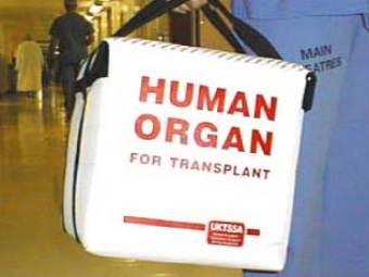 Иллюстрация с сайта cambridge-transplant.org.uk