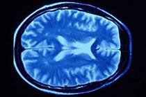 Иллюстрация с сайта neurology.ufl.edu