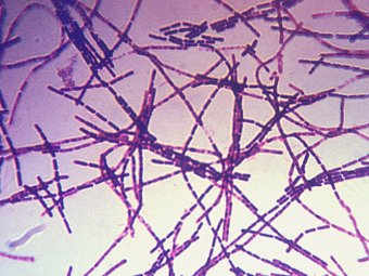 Возбудитель сибирской язвы - Bacillus anthracis, иллюстрация с сайта wikipedia.org