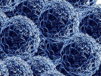 Наночастицы серебра. Изображение с сайта www.nextscience.org