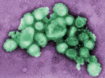 Вирус гриппа H1N1. Изображение с сайта cdc.gov