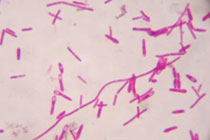 Споры Clostridium botulinum. Фото с сайта http://er1.org