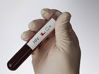 Иллюстрация с сайта  aidscommunity.com