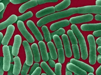 Возбудитель сальмонеллеза. Изображение с сайта www.defendingfoodsafety.com