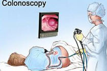 Колоноскопия, иллюстрация с сайта anesthesia.com