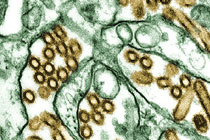 Вирусы гриппа H1N1 под электронным микроскопом