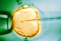 ЭКО, иллюстрация с сайта fertilityproregistry.com