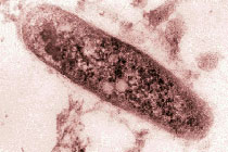 Возбудитель туберкулеза - mycobacterium tuberculosis, иллюстрация с сайта wadsworth.org