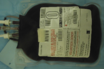 Фото с сайта yoursurgery.com