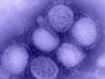 Грипп H1N1, иллюстрация с сайта cdc.gov