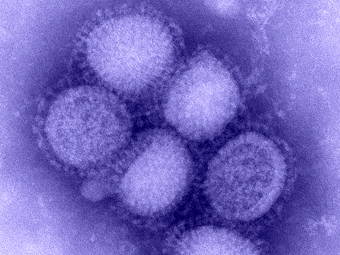 Вирусы гриппа Н1N1 под микроскопом. Фото с сайта www2c.cdc.gov