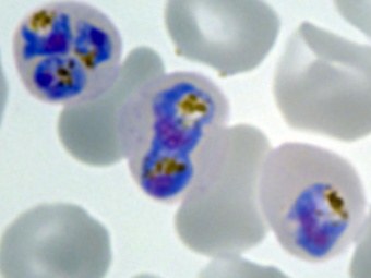Плазмодии в эритроцитах, фото с сайта sciencedaily.com