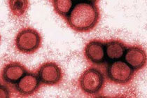 Вирус H1N1, фото с сайта khoahoc.com.vn