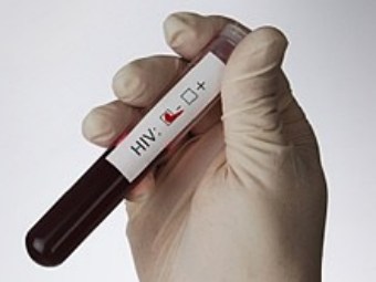Иллюстрация с сайта aidscommunity.com