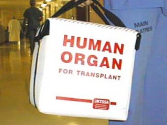 Изображение с сайта www.cambridge-transplant.org.uk