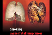 Фото с сайта www.packwarnings.nhs.uk