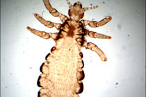 Pediculus humanus. Фото с сайта pathmicro.med.sc.edu
