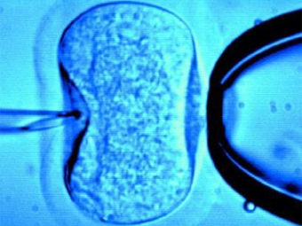 ИКСИ. Фото с сайта babble.com