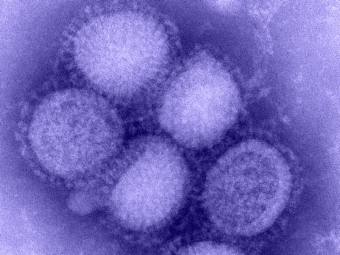 Грипп H1N1, иллюстрация с сайта cdc.gov