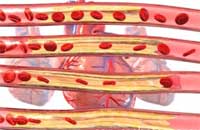 Ишемическая болезнь сердца. Фото с сайта www.sciencephoto.com