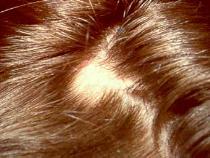 Фото с сайта www.skinsite.com