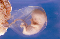 Маловодие. Многоводие. Фото с сайта www.nrlc.org