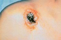  .    www.humanillnesses.com