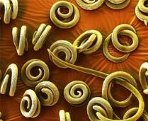 Trichinella spiralis. Фото с сайта www.sciencephoto.com