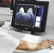 Изучение МР-томограммы молочной железы
