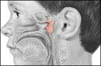 Чем чреваты аденоиды? Изображение с сайта www.nlm.nih.gov